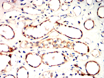 PCSK9 Antibody