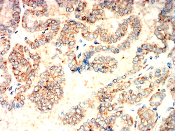 PCSK9 Antibody