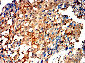 LDHA Antibody