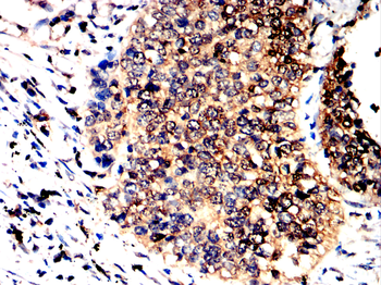 LDHA Antibody