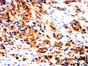 LDHA Antibody