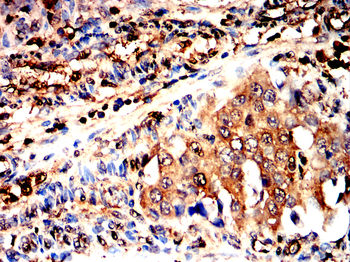 LDHA Antibody