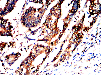 LDHA Antibody