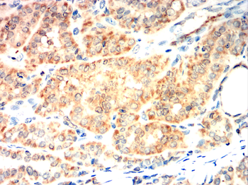 LDHA Antibody