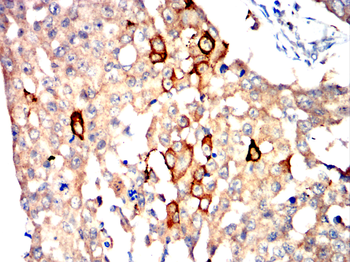 PTPRB Antibody