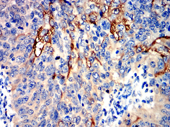 PTPRB Antibody