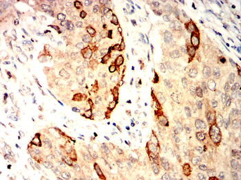 PTPRB Antibody