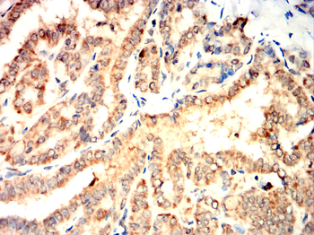PTPRB Antibody
