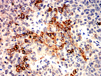 AQP5 Antibody