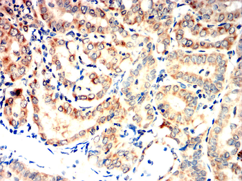 AQP5 Antibody