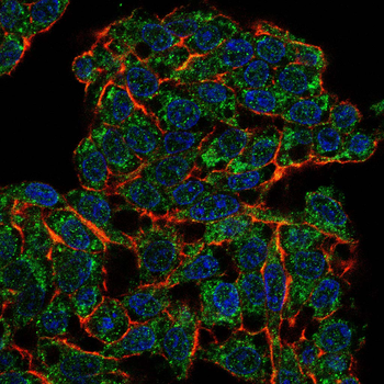 ENPP3 Antibody