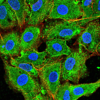 CTSD Antibody