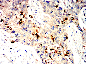 CTSD Antibody