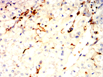 CTSD Antibody