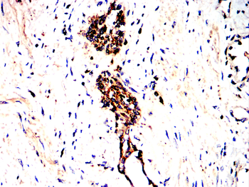 CTSD Antibody