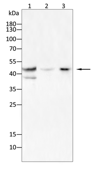 CTSD Antibody
