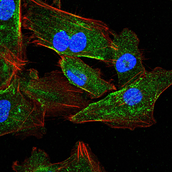DKK1 Antibody