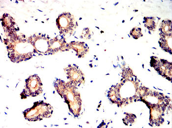 DKK1 Antibody