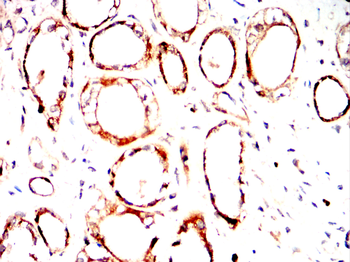 DKK1 Antibody