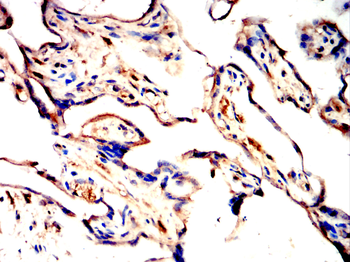 DKK1 Antibody