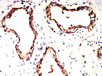 DKK1 Antibody