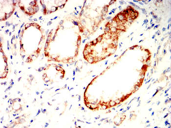 PDCD6IP Antibody