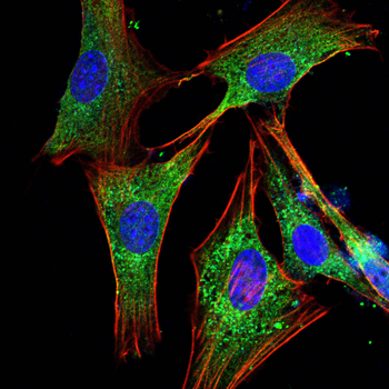 NFKB1 Antibody