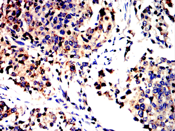 NFKB1 Antibody