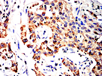 NFKB1 Antibody