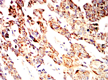 NFKB1 Antibody