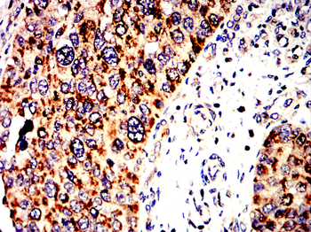 NFKB1 Antibody