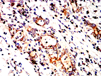 NFKB1 Antibody