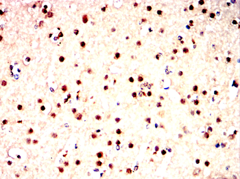 RB1 Antibody