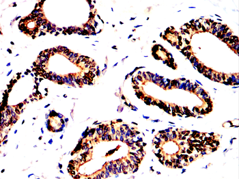 RB1 Antibody
