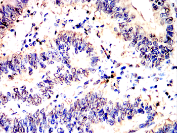 RB1 Antibody