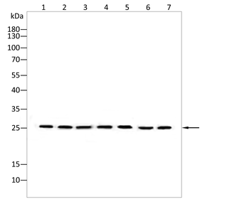 SOD2 Antibody