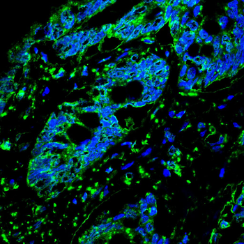 SOD2 Antibody
