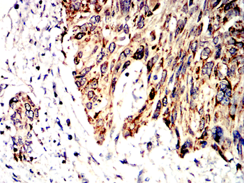 SOD2 Antibody