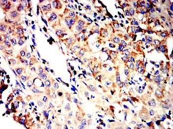SOD2 Antibody