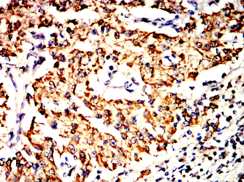 SOD2 Antibody