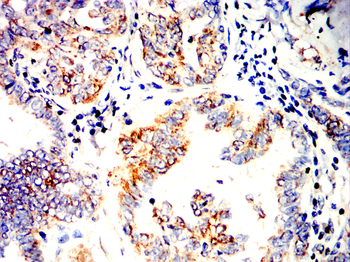 SOD2 Antibody