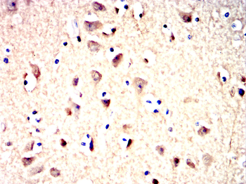 ENO2 Antibody