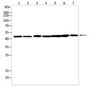 ENO2 Antibody