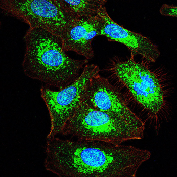 IFNG Antibody