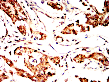 IFNG Antibody