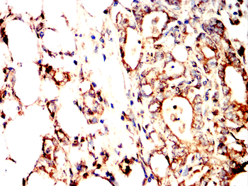 IFNG Antibody