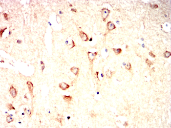 DLG4 Antibody