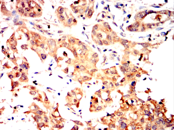 CYBB Antibody