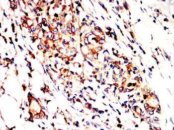 CYBB Antibody
