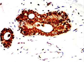 ABCG1 Antibody